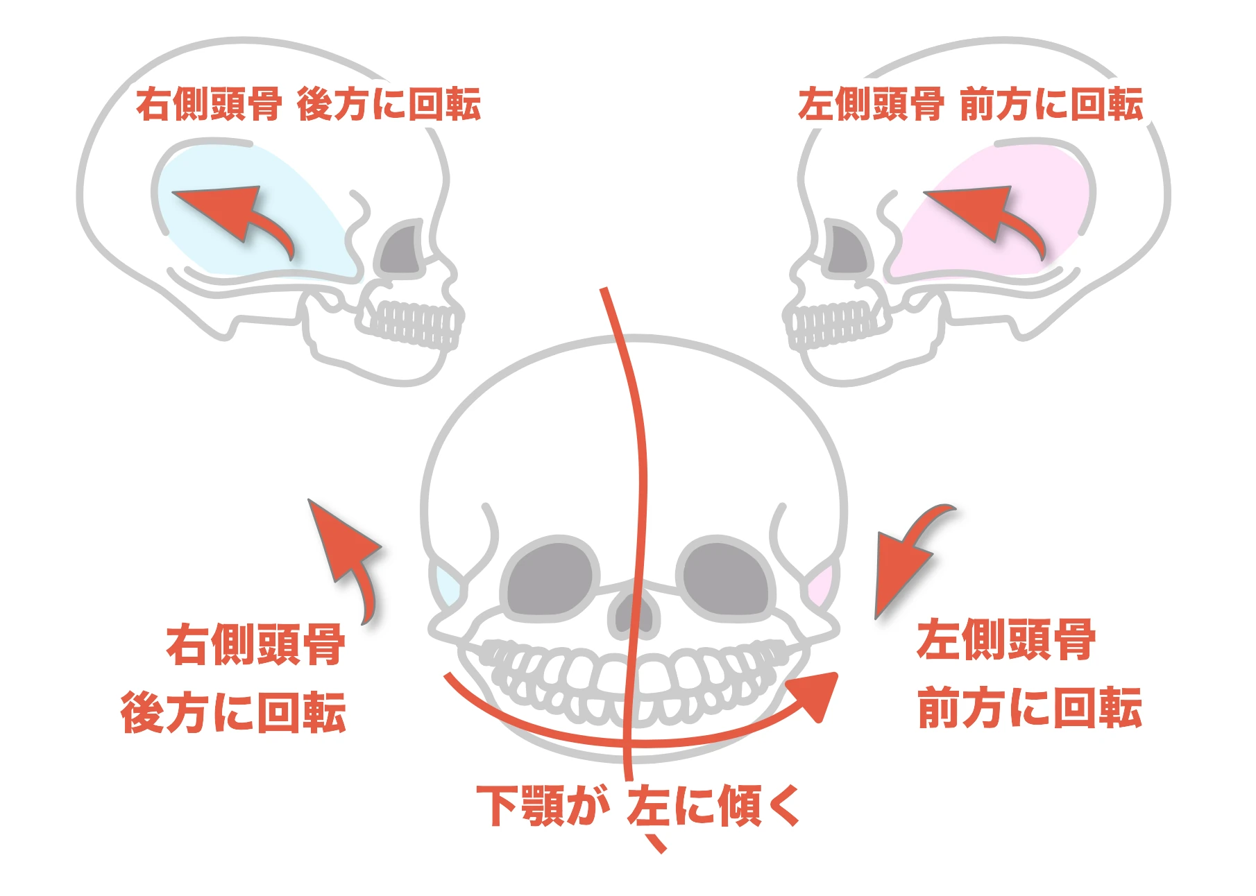 小顔矯正　施術例　写真