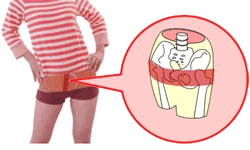 体型・体質を整えるオーダーメイドの簡単体操イメージ｜骨盤美容整体の効果を定着させ、日々の姿勢を美しく保つためのセルフケア指導