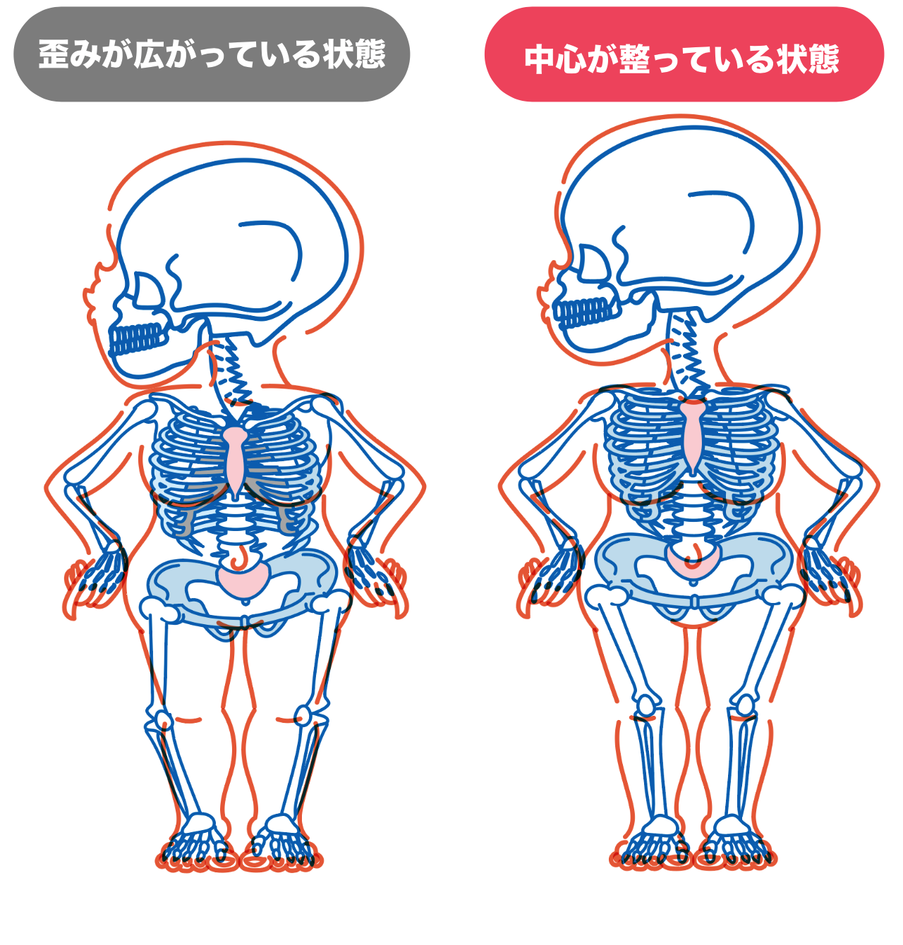 産前産後の骨格図｜産後に広がりきった骨盤と肋骨の歪みを整えるイメージ